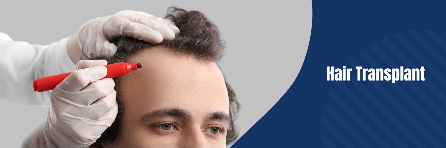 Hair Transplant